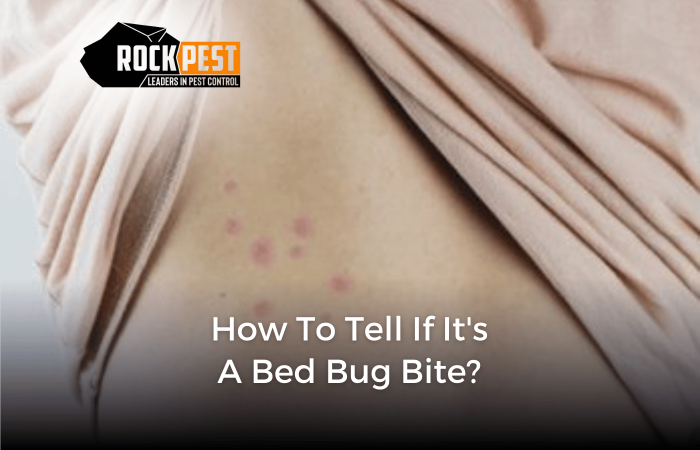 How to Tell if It’s a Bed Bug Bite