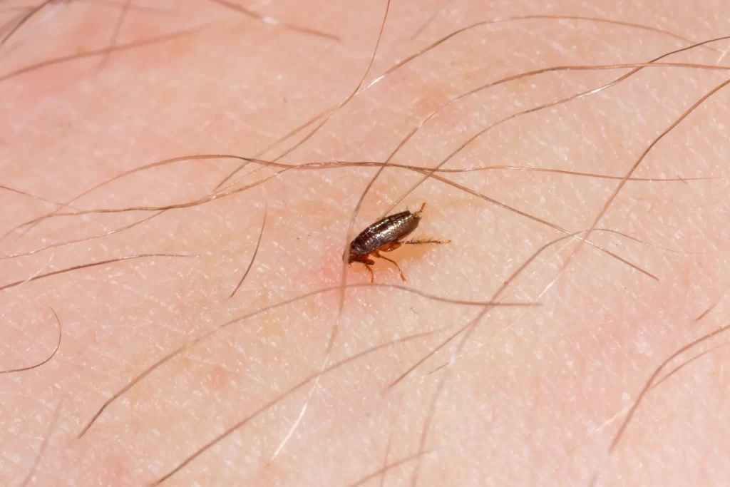 Close-up of a flea on human skin, illustrating the pest issue highlighted in Kansas City during late summer, emphasizing the need for pest control services to address flea infestations.